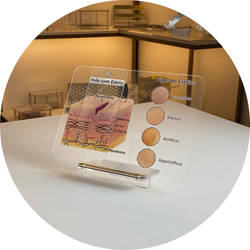 06 tipos de estrias quadro de marcacao macromodelo guia dermatologico e estetico