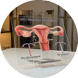 04 diu dispositivo intrauterino quadro de marcacao macromodelo guia ginecologico g dourado
