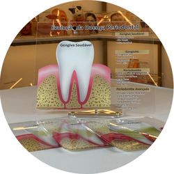 08 estagios da doenca periodontal quadro de marcacao macromodelo guia odontologico