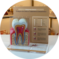 07 anatomia dental estagios da carie e tratamento endodontico display macromodelo